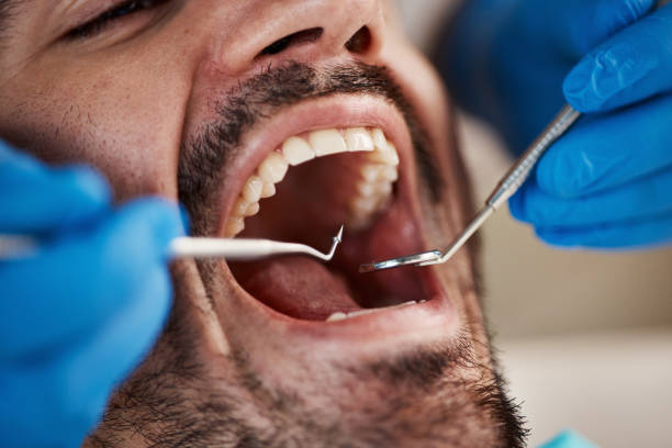 Best Emergency Dental Care for Broken or Chipped Teeth in Medford, MN